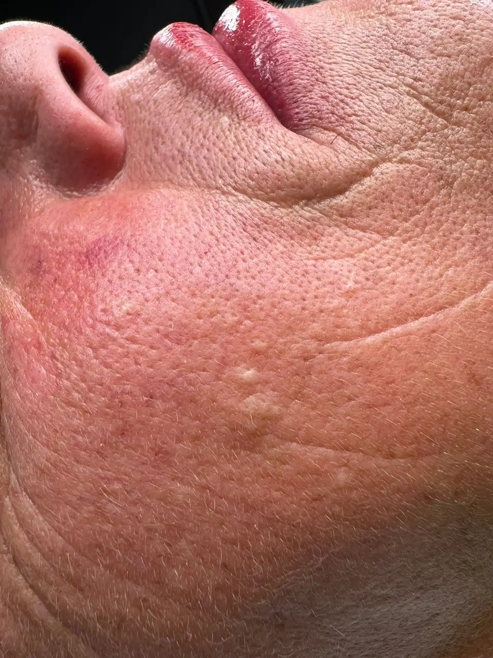 Falten und Anti-Aging behandeln